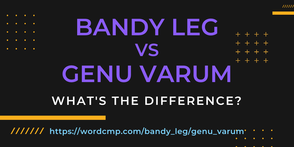 Difference between bandy leg and genu varum