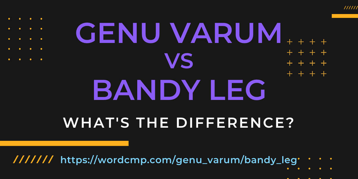 Difference between genu varum and bandy leg